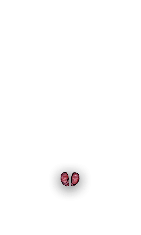 prostate